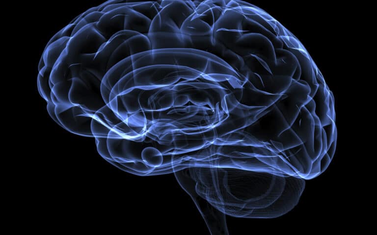 Xray image of a human head brain